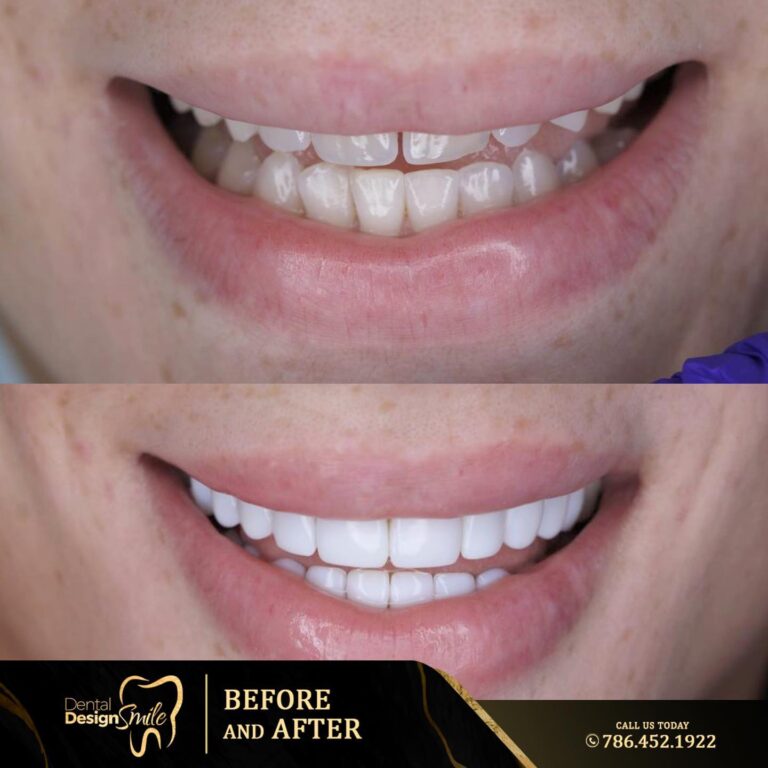 Gallery Dental Design Smile   Dentaldesignsmile 20220923 0004 768x768 