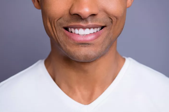 dental desing smile miami