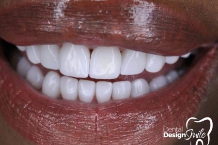 dentaldesignsmile-20220923-0025